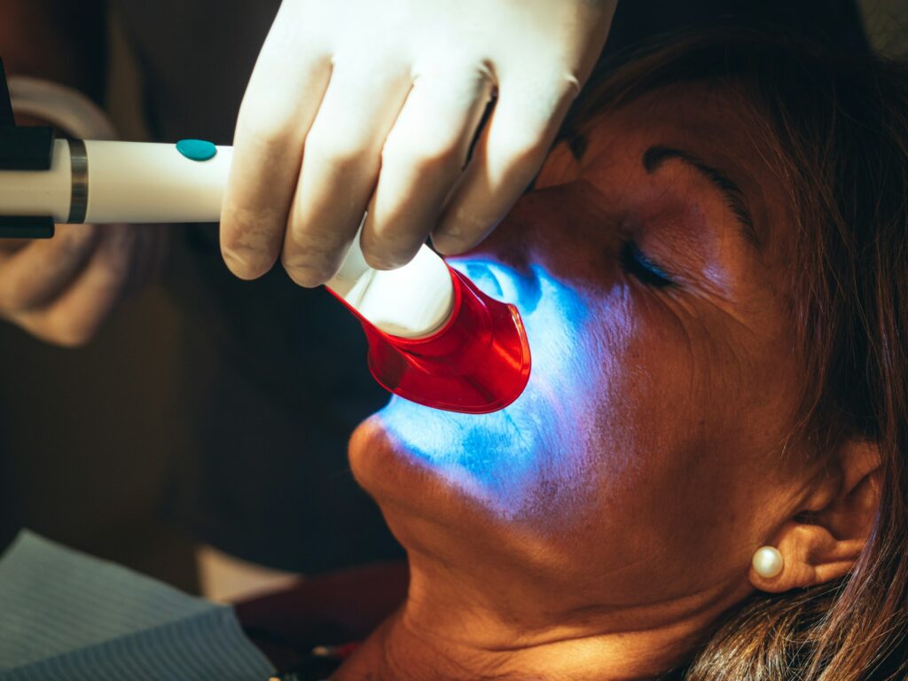 Stained Teeth